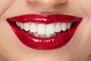 porcelain-veneers-red-bank-dentist-1